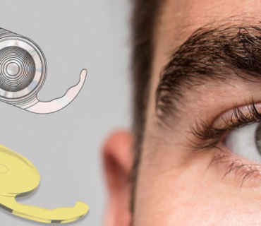 How Intraocular Lenses Improve Vision After Cataract Surgery