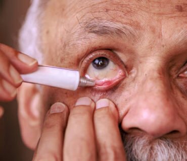 Top Benefits of Using Medically Approved Eye Ointments